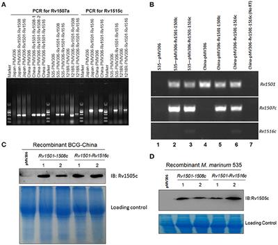 The Impact of Genome Region of Difference 4 (RD4) on Mycobacterial Virulence and BCG Efficacy